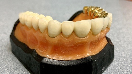 Model smile with dental restorations