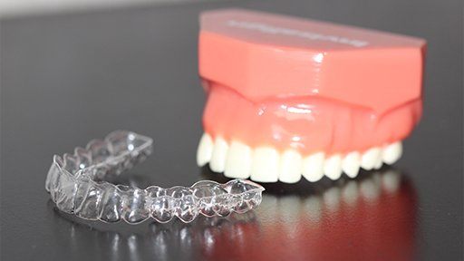 Model smile and Invisalign alignment tray