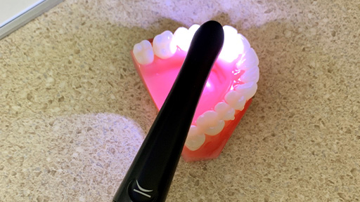 Intraoral camera capturing smile photo